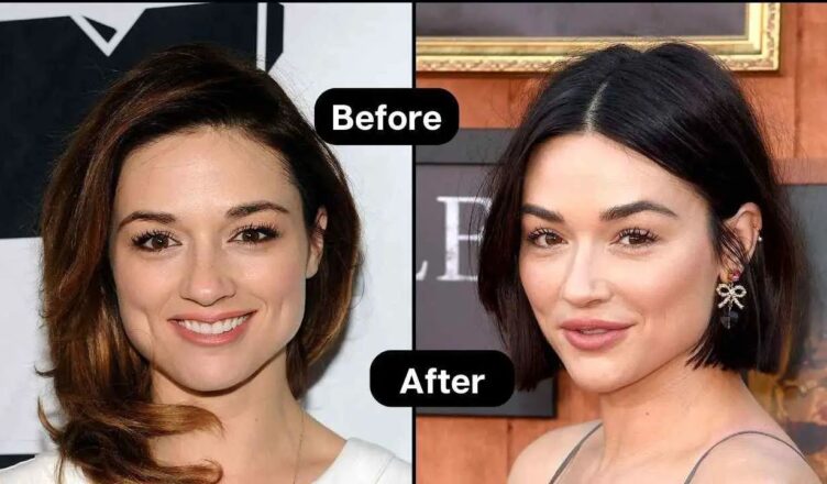 The Truth About Crystal Reed's Plastic Surgery